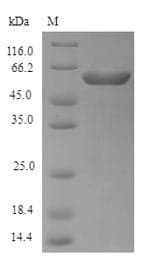 Escherichia coli Exopolyphosphatase Protein (Recombinant 6His, N-terminus)