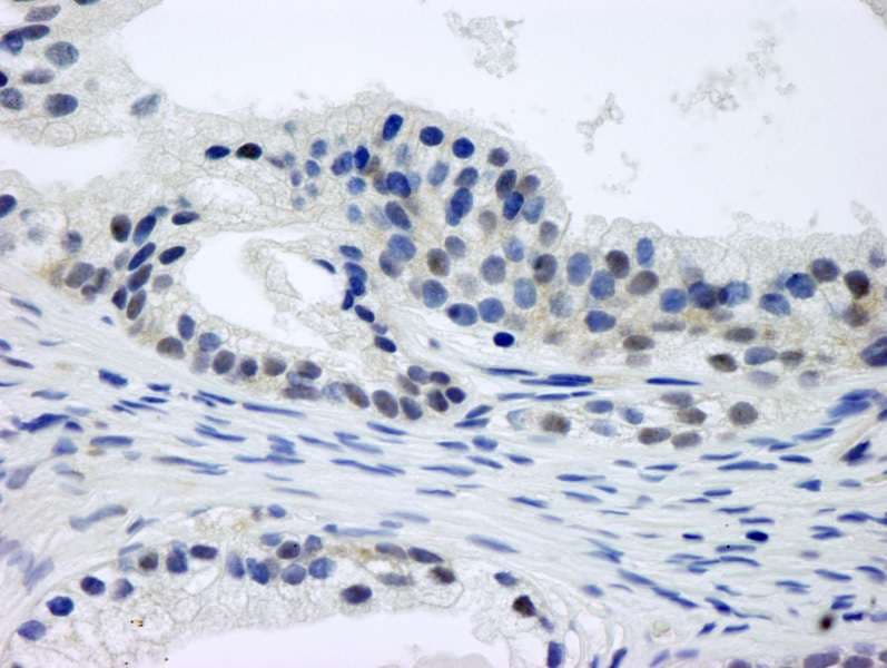 GPS1 / CSN1 Antibody (aa400-C-term)