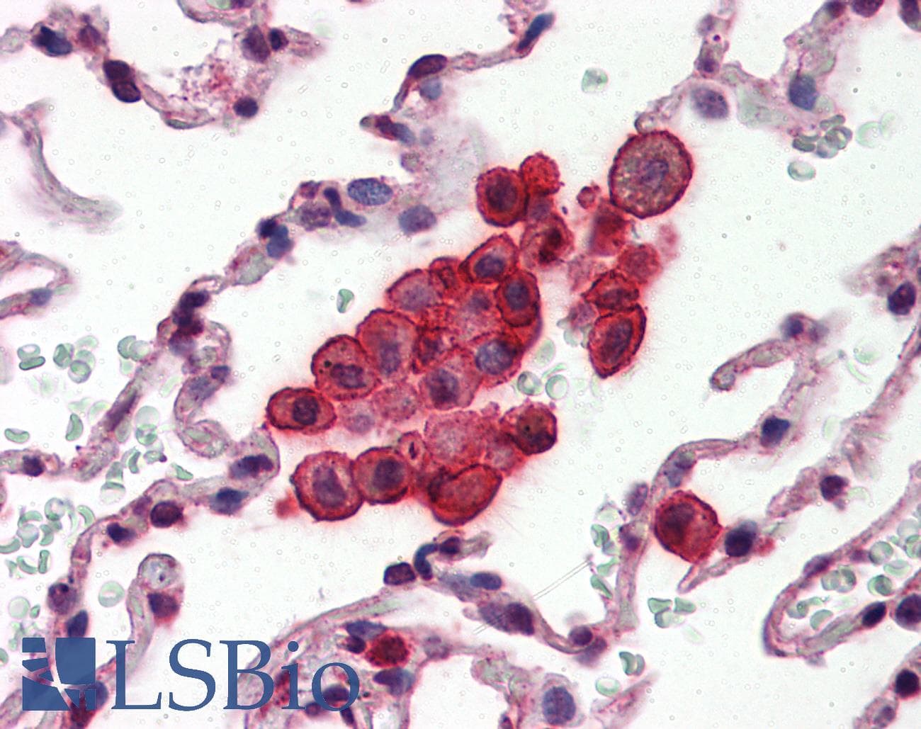IHC-plus™ CLU / Clusterin Antibody (aa1-333, clone 1A11)