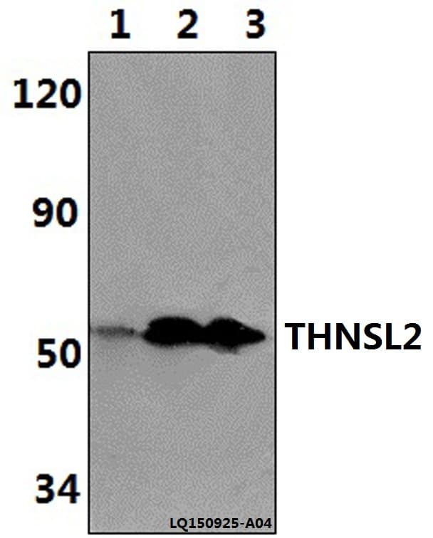Polyclonal Rabbit anti-Human THNSL2 Antibody (aa103-148, WB)