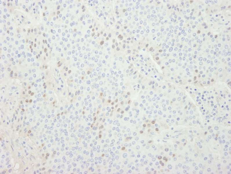 CDT1 Antibody (aa500-C-term)