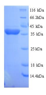 Rat RGN / Regucalcin Protein (Recombinant His)
