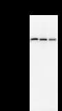 Monoclonal Mouse anti-Human PRPF8 Antibody (clone 2834C1a, IF, WB)