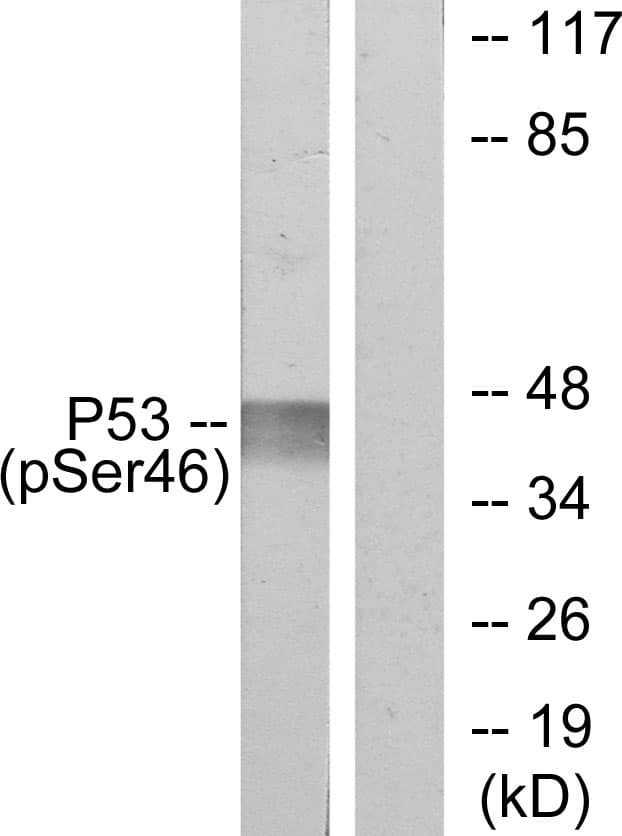 Polyclonal Rabbit anti-Human TP53 / p53 Antibody (phospho-Ser46, WB)