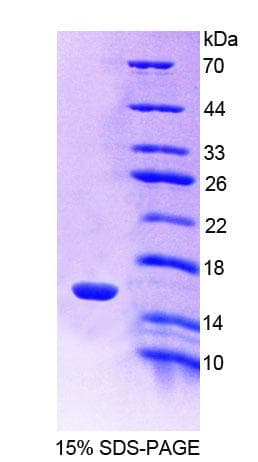 Mouse CFB / Complement Factor B Protein (Recombinant His)