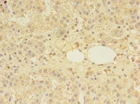 MS / MTR Antibody