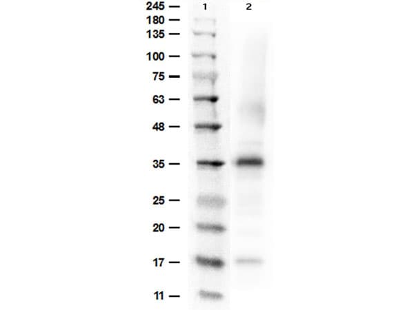 ARG1 / Arginase 1 Antibody (Liquid)