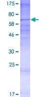 Human TRAM1L1 Protein (Recombinant GST)