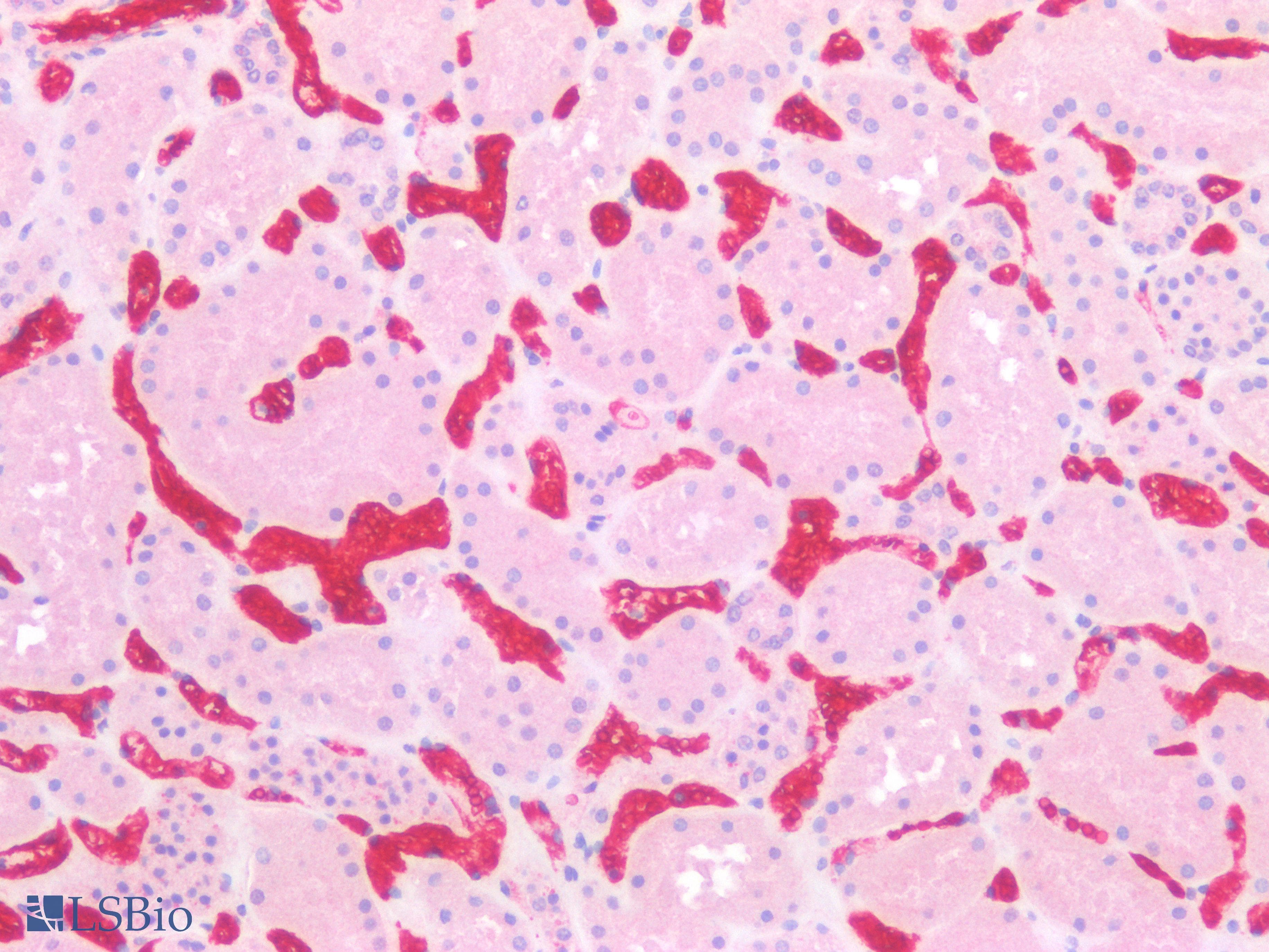 PathPlus™ SLC2A1 / GLUT-1 Antibody (Concentrated)
