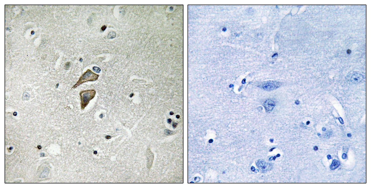 RNF149 Antibody