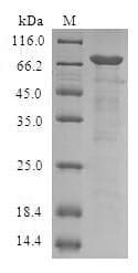 Human SIRPB1 / CD172b Protein (Recombinant 6His, N-terminus)
