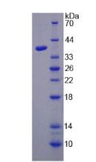 Human HARS Protein (Recombinant His-T7, N-terminus)