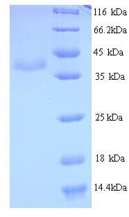 BK Polyomavirus Minor Capsid Protein VP2 (Recombinant His)