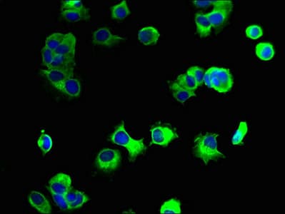 GPM6A / Glycoprotein M6A Antibody