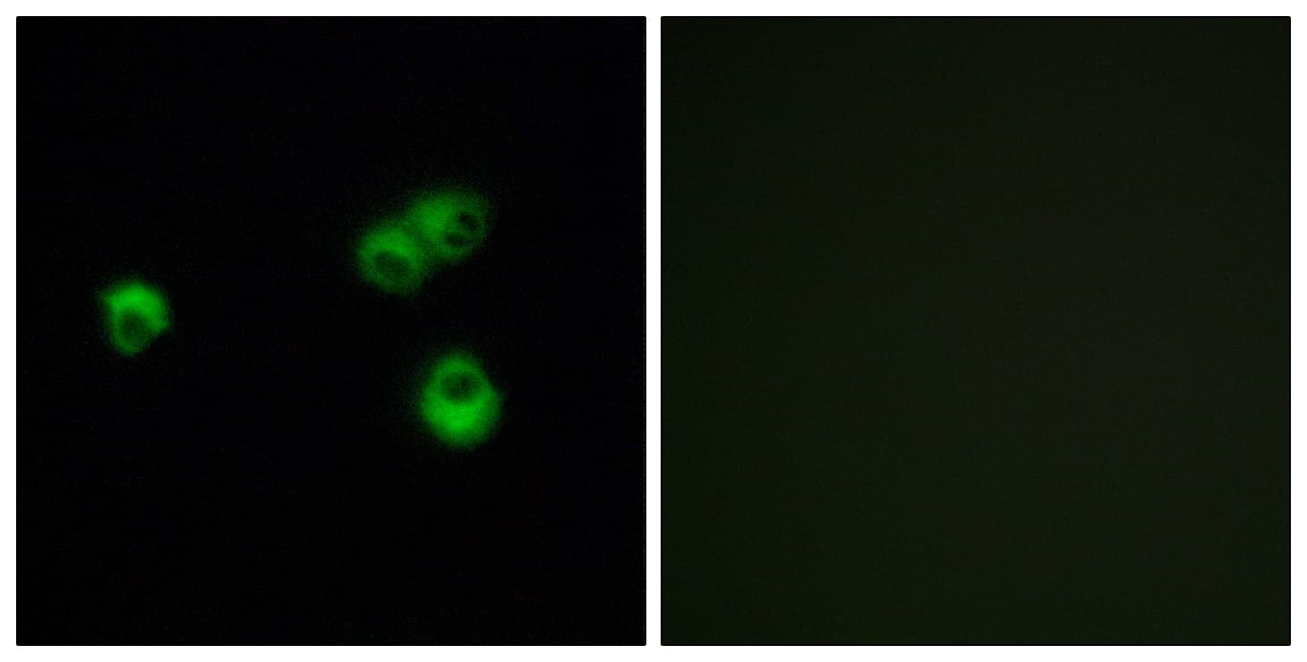 OR7E5P Antibody
