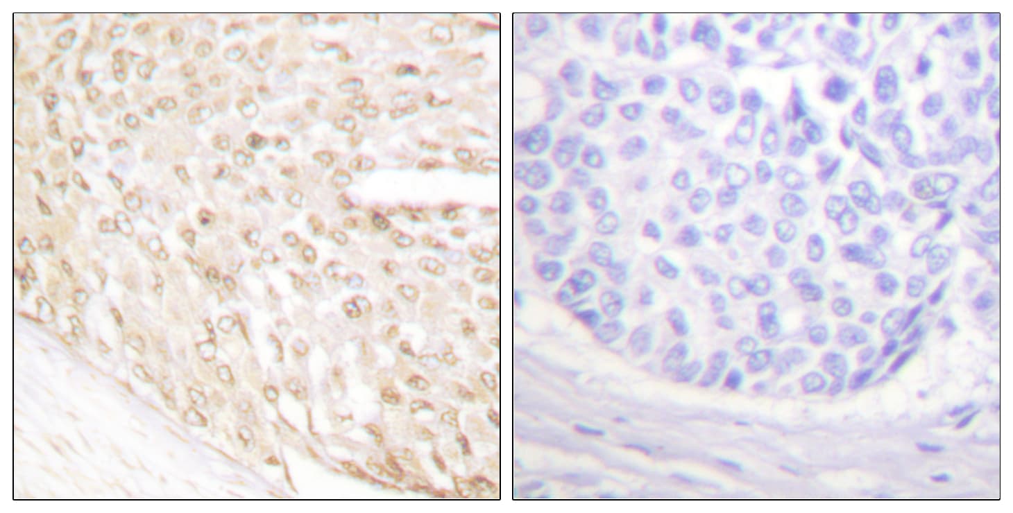 CDKN2C / p18 INK4c Antibody (aa111-160)