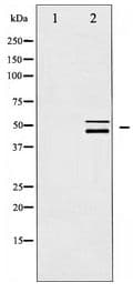 Polyclonal Rabbit anti-Human p66 / SHC Antibody (IHC, WB)