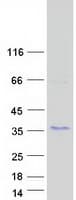 Human KRTAP27-1 Protein (Recombinant Myc-DDK (Flag))
