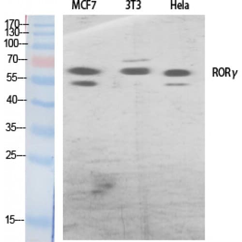 RORC / ROR Gamma Antibody (40-120 aa, Internal)