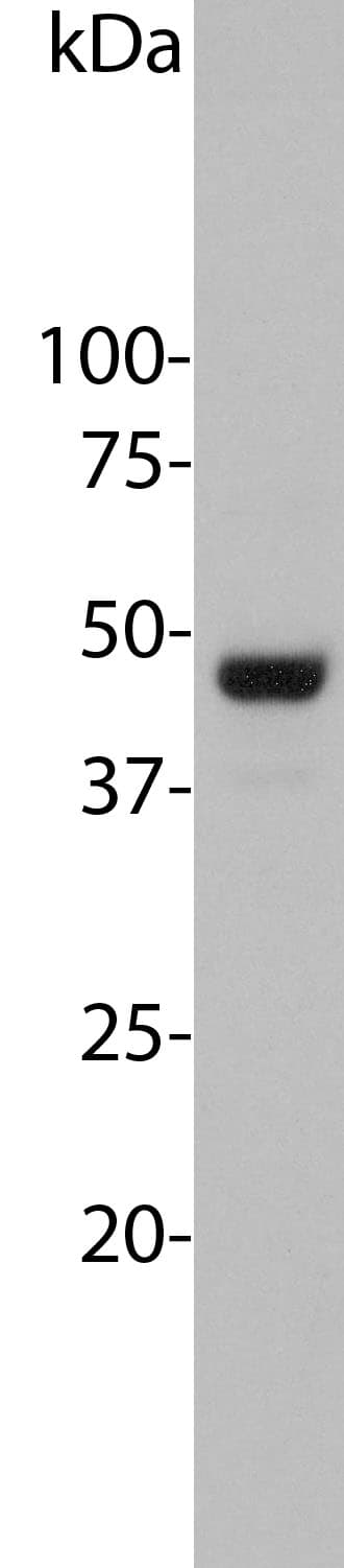 AURKA / Aurora-A Antibody (clone 3H1)