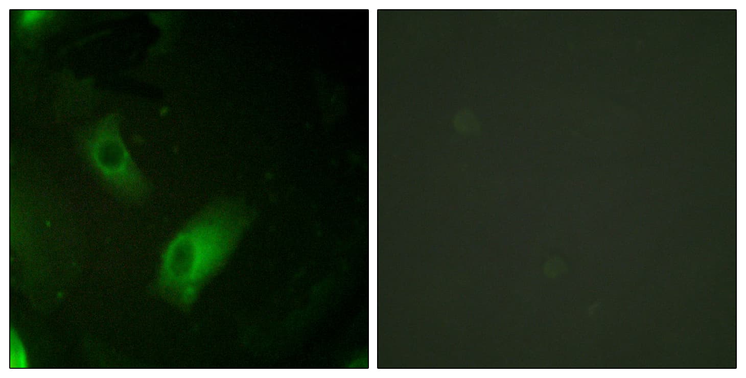 ACO1 / Aconitase Antibody (aa106-155)