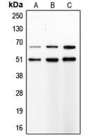 Polyclonal Rabbit anti-Human MMP8 Antibody (C-Terminus, IHC, IF, WB)