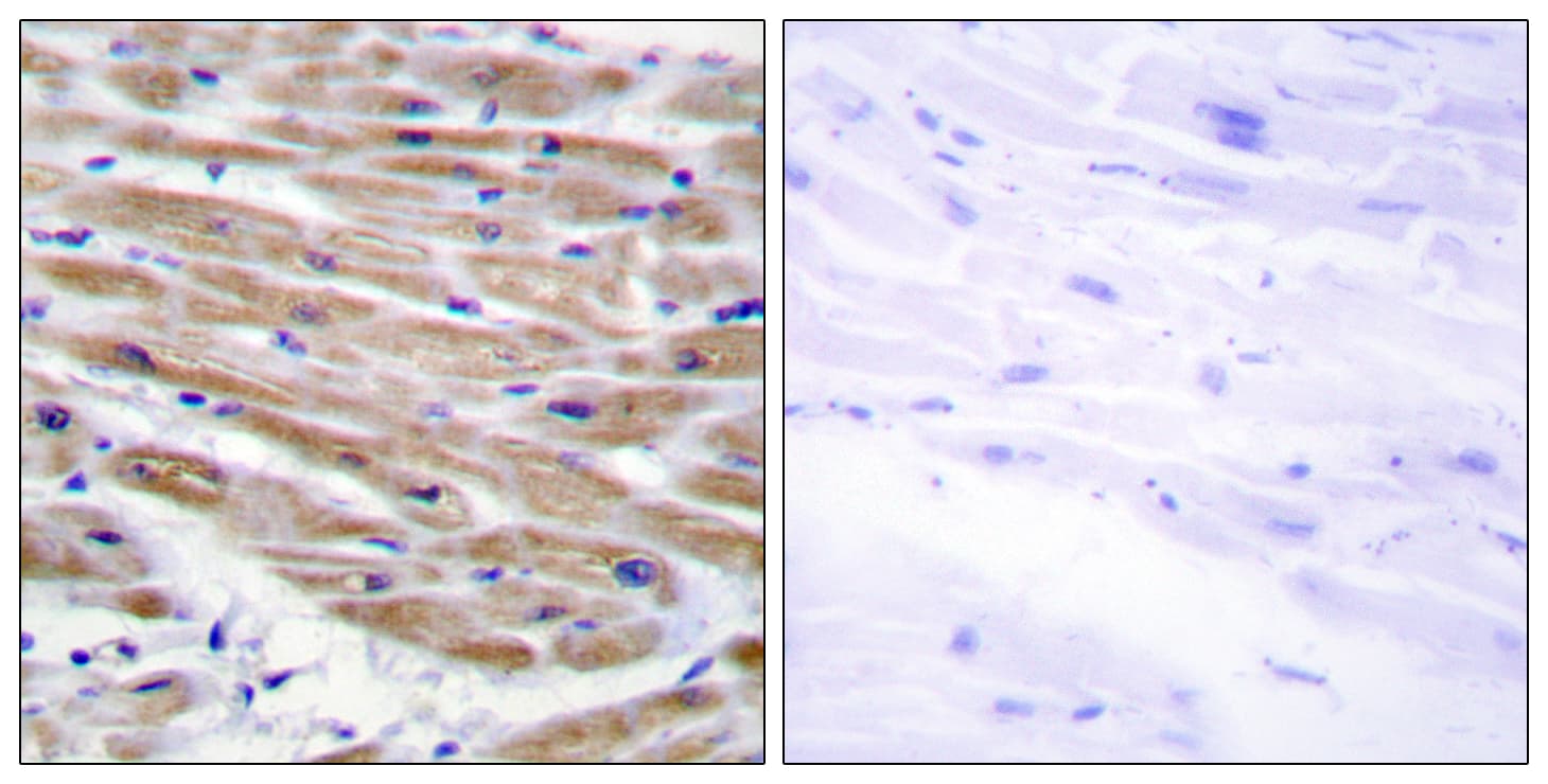 MAP3K4 / MEKK4 Antibody (aa1281-1330)