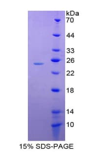 Human MAG Protein (Recombinant His-T7)