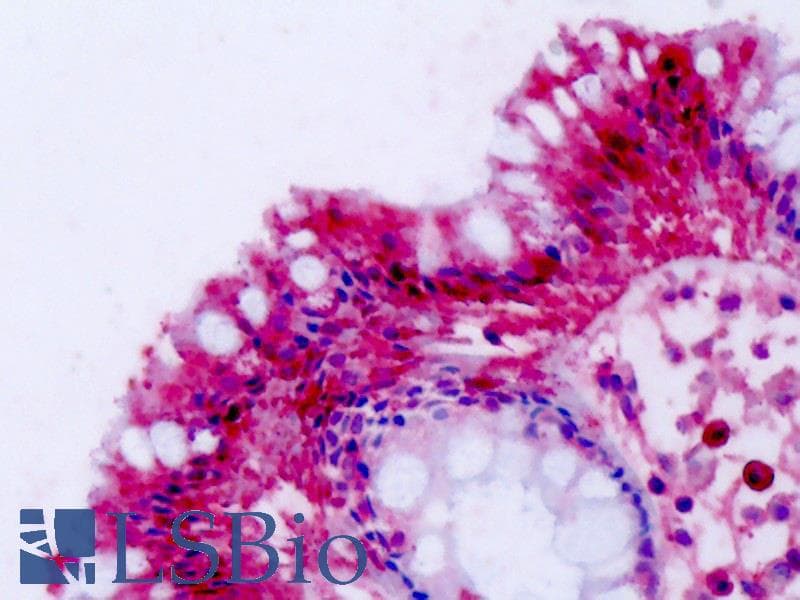 IHC-plus™ Polyclonal Rabbit anti-Human NPFF2 / NPFFR2 Antibody (C-Terminus, IHC)