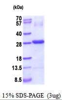 Human CTHRC1 Protein (Recombinant His)