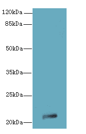 JAGN1 Antibody