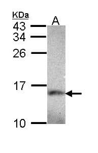 NDUFA5 Antibody (aa1-116)
