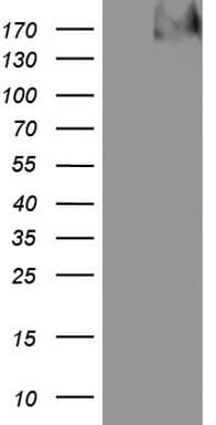 Monoclonal Mouse anti-Human TG / Thyroglobulin Antibody (clone OTI8F6, aa20-358, IHC, WB)
