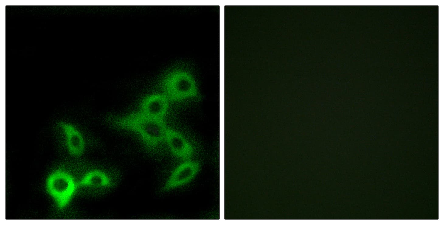 GPBAR1 / TGR5 Antibody (aa11-60)