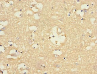 Polyclonal Rabbit anti-Human CHRNA9 Antibody (IHC)