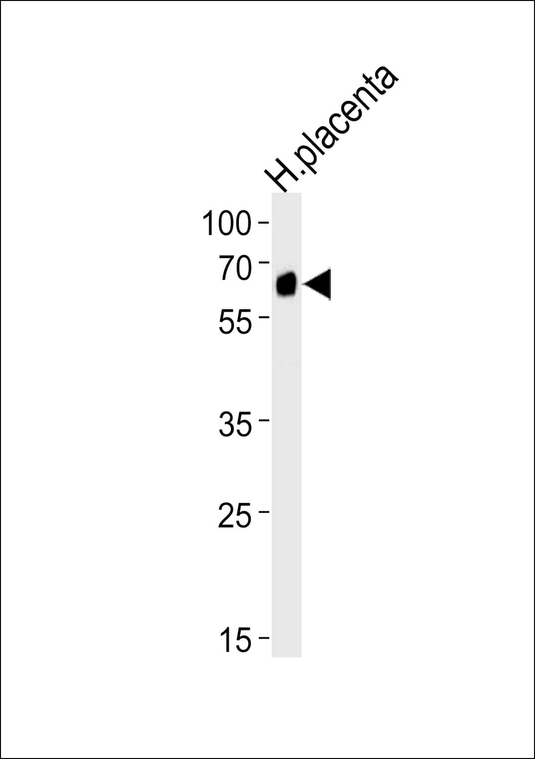 STK39 / SPAK Antibody (aa386-415)
