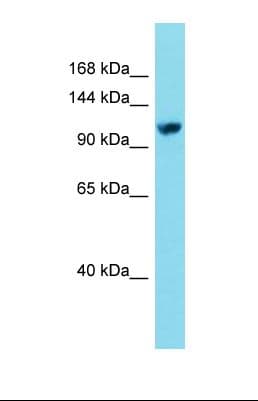 Polyclonal Rabbit anti-Human EFTUD2 Antibody (aa328-377, WB)