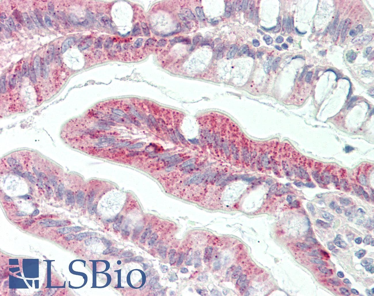 IHC-plus™ Polyclonal Rabbit anti-Human FZD5 / Frizzled 5 Antibody (aa461-510, IHC, IF, WB)