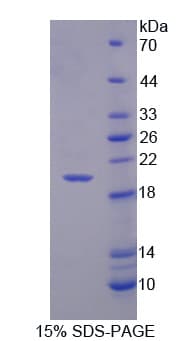 Human CD99 Protein (Recombinant His-T7)