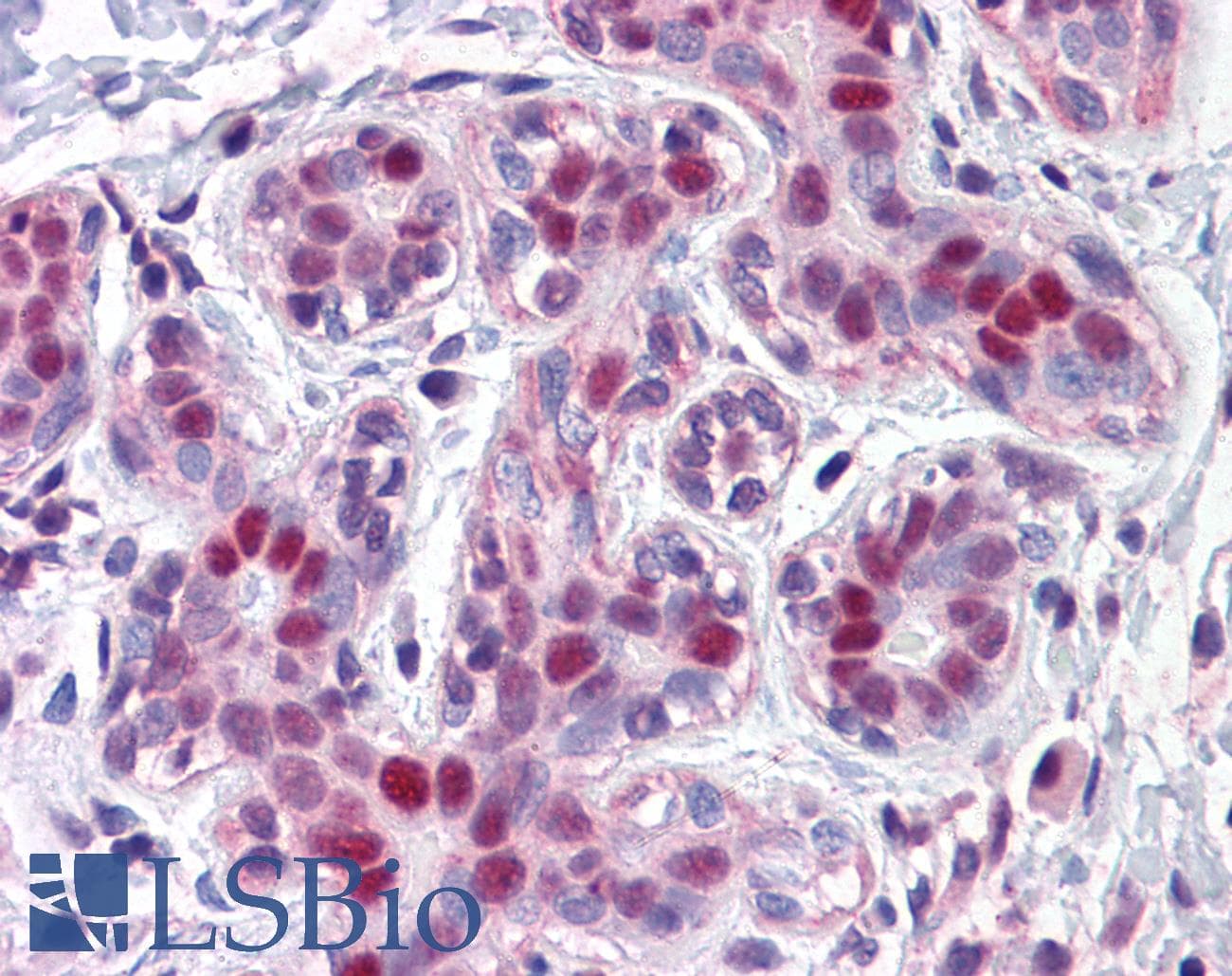 IHC-plus™ LMO4 Antibody (clone 2B6)