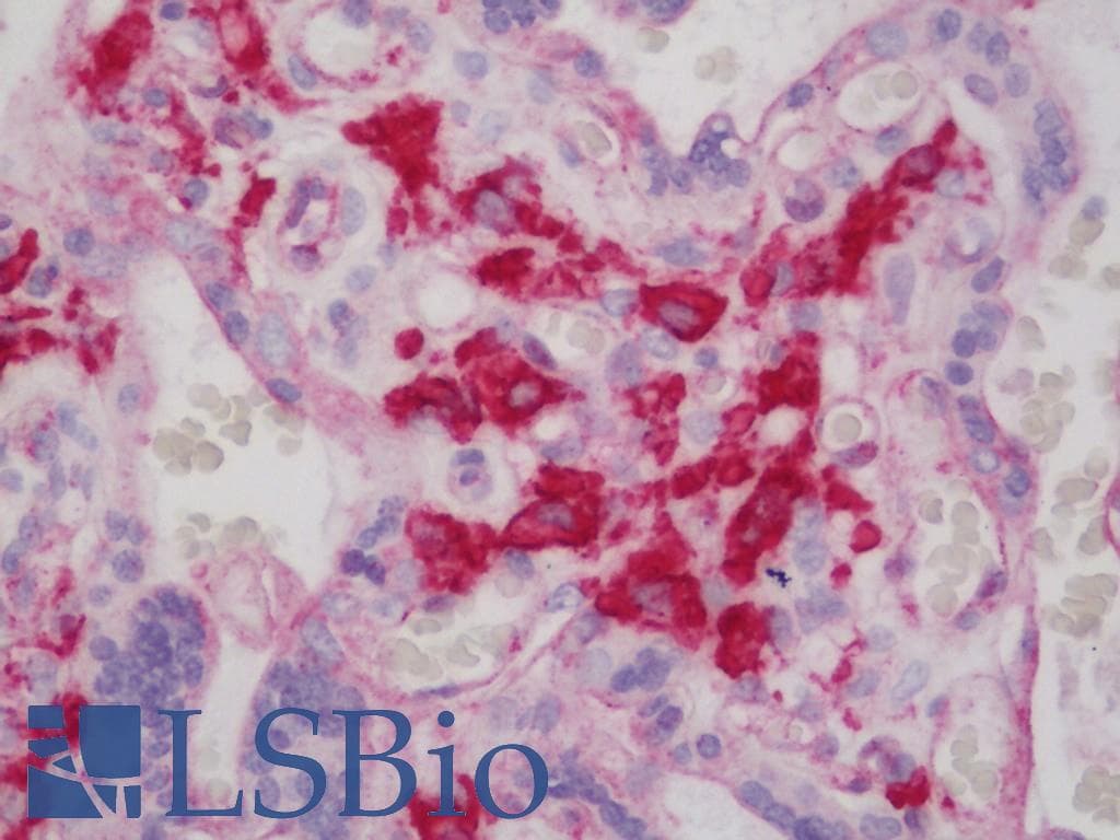 IHC-plus™ FCGR1A / CD64 Antibody (clone OTI1A8)