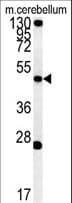 ENPP6 Antibody (aa170-197)