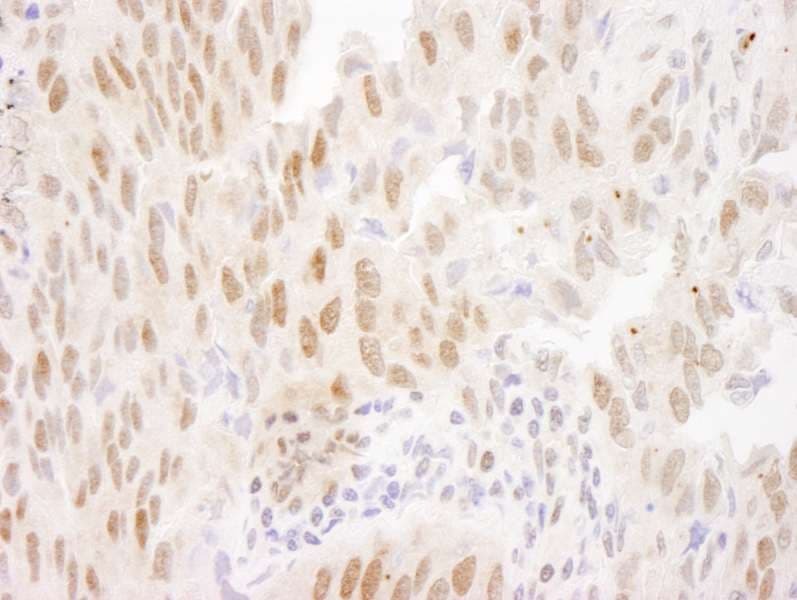 FOXO3 / FOXO3A Antibody (aa625-C-term)
