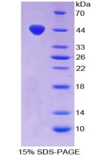Mouse RARRES2 / Chemerin Protein (Recombinant His-GST)