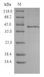 Human CXCR3 Protein (Recombinant 6His, N-terminus)