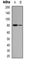 MRE11A / MRE11 Antibody (Internal)