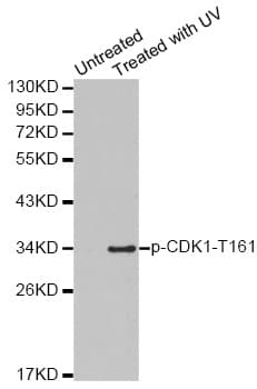 Polyclonal Rabbit anti-Human CDK1 / CDC2 Antibody (phospho-Thr161, IHC, WB)