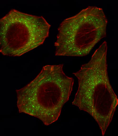 Polyclonal Rabbit anti-Human CACNA2D2 Antibody (aa643-671, IHC, IF, WB)