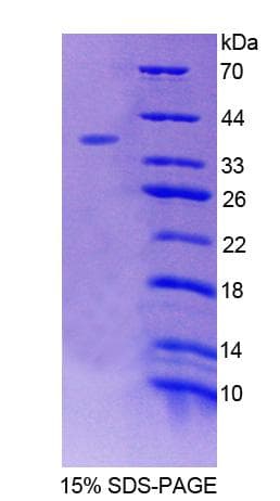 Human EED Protein (Recombinant His-T7)
