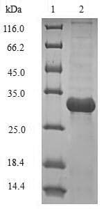 Klebsiella pneumoniae bamA Protein (Recombinant 10His-B2M, N-terminus + Myc, C-terminus)